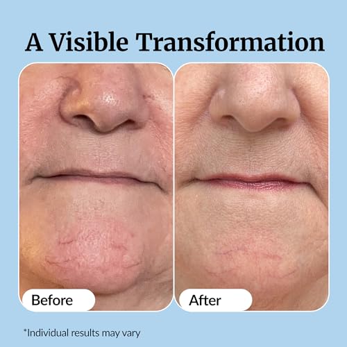 Vibriance Super C Serum for Mature Skin - All-in-One Vitamin Formula Hydrates, Firms, Lifts, Smooths, Targets Age Spots, Wrinkles, 1 fl oz - Pack of 3