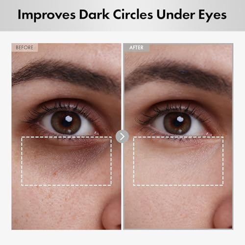 NATUREKIND Hyaluron Lifting Eye Cream, Hyaluronic Acid, 5% arbutin, Niacinamide for Puffy Eyes, Dark Spot and Fine Lines, Hydrating Under Eye Bag, Korean Skin Care, 15ml, 0.5 fl. oz.