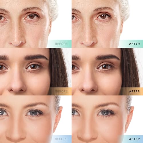 Cosmedica Skincare Facial Serum Trio Set Value for Clear Skin - Vitamin C Super Serum, 2.5% Retinol Serum, Pure Hyaluronic Acid Serum – Vegan, Cruelty-Free Skincare 3 pack