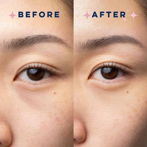 CLEAN SKIN CLUB Brightening+ Stem Cell Eye Cream, Reduces Dark Circles & Puffiness, Fragrance Free, 1.2 fl oz (Pack of 1)