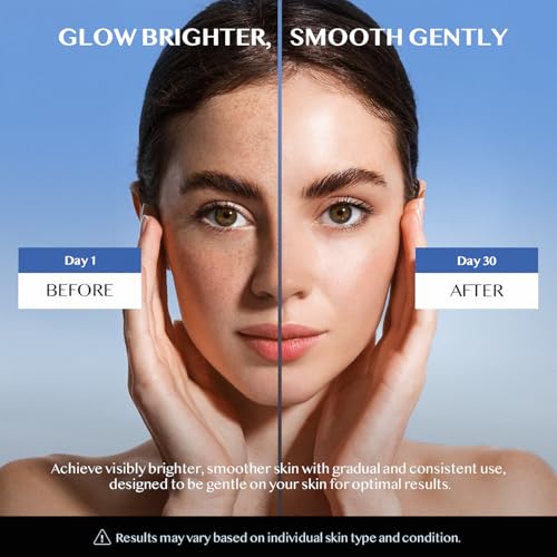 Dark Spot Remover for Face and Body: Dark Spot Remover - Melasma, Freckle, Sun Spot, Age Spot Remover Advanced Formula with Niacinamide for Women and Men(1.7 Fl Oz)
