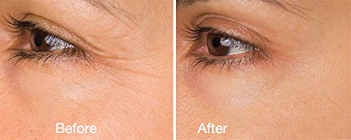 DNA Code-No Needle Alternative-Argireline Copper Peptide Wrinkle Reduce Serum Booster w/Snap-8, Matrixyl 3000