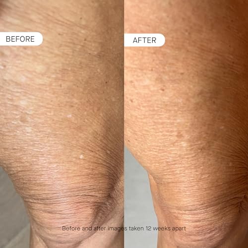 OneSkin BODY OS-01 Peptide Skin Longevity Daily Moisturizer- Improves Skin Texture & Barrier, For All Skin Types Including Sensitive Skin