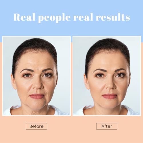 Face Moisturizer with SPF | Retinol Cream for Face | Age-Defying, Lift & Firm Cream | Face Lift & Repair | Collagen | Retinol | Skincare | Face Moisturizer with Sunscreen | Instant Hydration | 1.7oz