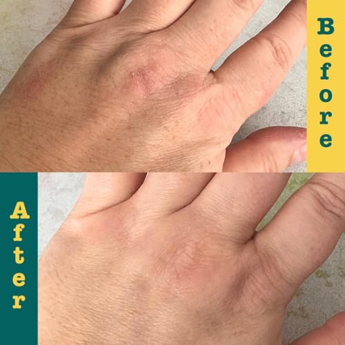 APTO Soothing Ointment w/Turmeric & Calendula: Ultra-Moisturizing Barrier Cream for Dry, Chapped Skin on Your Body, Face, or Lips, 3 oz.