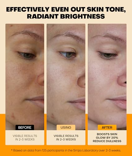 Pure Natural Skin Brightening & Anti Aging 20% Vitamin C Serum, Collagen Peptide Infused Face Serum for Deep Hydration, All-in-One Serum with Niacinamide, Retinol, Hyaluronic Acid, 2.02 Fl Oz