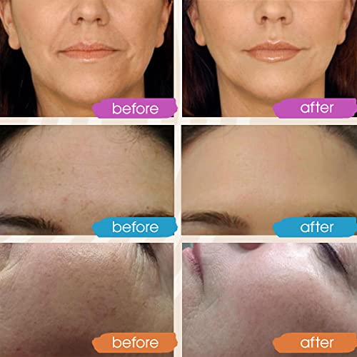 GLEOW Vitamin C Face Serum, Hydrating Vitamin C Serum for Face with Hyaluronic Acid, Suitable For All Skin Types, Targets the Appearance of Dull Spots 2oz