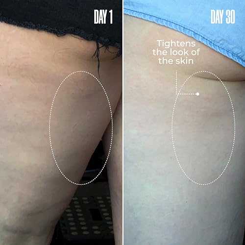 MAËLYS Cosmetics B-TIGHT Leave-On Cellulite Mask - Reduces The Appearance Of Cellulite - Visibly Tightens The Skin In The Butt Area