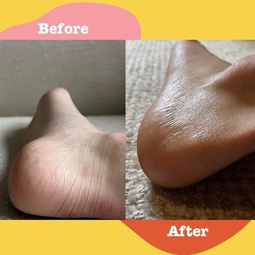 APTO Soothing Ointment w/Turmeric & Calendula: Ultra-Moisturizing Barrier Cream for Dry, Chapped Skin on Your Body, Face, or Lips, 3 oz.