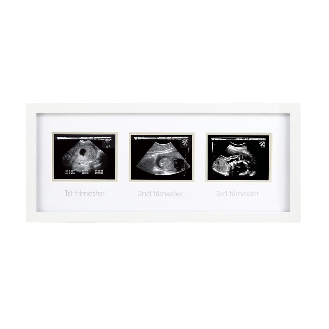Pearhead Sonogram Progression Frame - Trimester by Trimester Pregnancy Milestone Keepsake, Gender-Neutral Nursery Decor, Displays 1st, 2nd & 3rd Trimester Ultrasound Photos, White