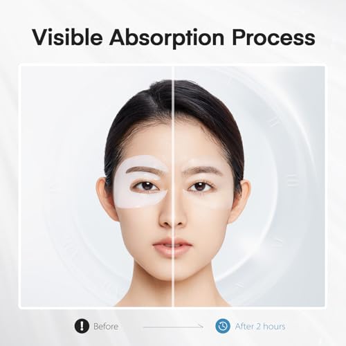 Dongyu Collagen Under Eye Patches: Real Collagen Overnight Eye Gels Mask With Caffeine Peptides Niacinamide - Dark Circles Puffiness Eye Bags Improvement - Wrinkles Smile Line Skincare Pads - 6 Pairs