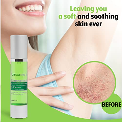 Princereigns Princereigns Ingrown Hair Serum