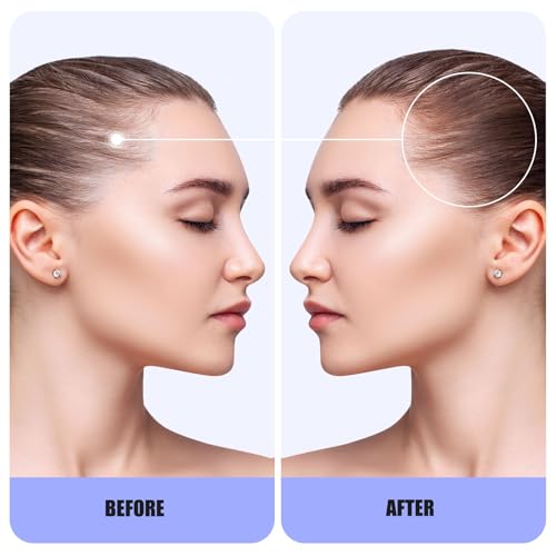 Biotin & Rosemary Shampoo for Hair Growth: Hair Loss Shampoo for Thinning Hair for Women and Men - Hair thickening Shampoo Infused with Natural Nutrient Rich Ingredients Sulfate Free 10 fl oz
