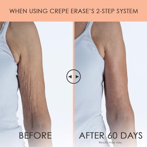 Crepe Erase Advanced Body Repair Treatment, Anti-Aging Skin Care Moisturizer for Body and Neck, Firming Cream to Support Wrinkle & Crepe Skin, Promotes Natural Elastin & Collagen Production, 10 oz