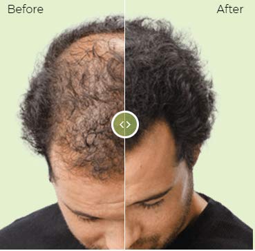 Hair Building Formula (Dark Blonde)