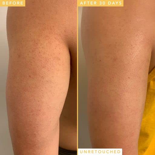 Farmacy Honeymoon Glow Body - AHA and BHA Body Serum with Hyaluronic Acid - Resurfacing Lactic Acid Body Lotion for Dry Skin