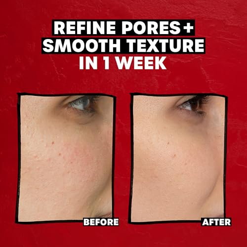 Thayers 2% AHA Exfoliating Toner with Glycolic Acid, Lactic Acid and Witch Hazel, Smoothing and Pore Refining Skin Care for All Skin Types, 12 Fl Oz