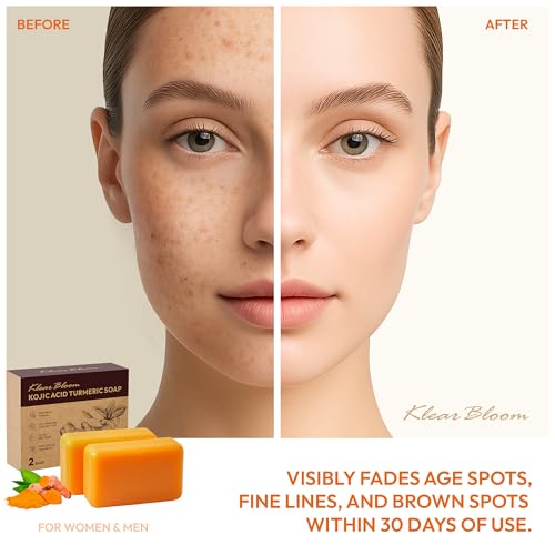 KlearBloom Kojic Acid Soap, Turmeric Soap Bar for Dark Spots with Collagen, Vitamin E, Retinol, Hyaluronic Acid, Shea Butter - 105g x 2 Bars With Holder