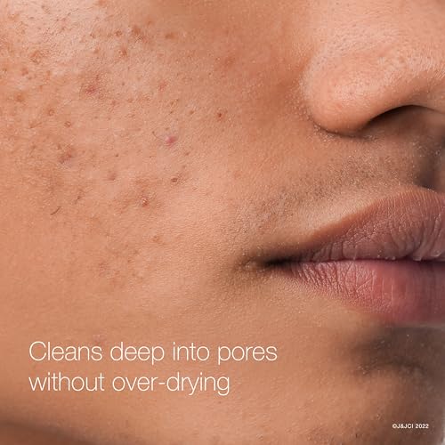 Neutrogena Rapid Clear Maximum Strength Acne Face Pads with 2% Salicylic Acid Acne Medication to Help Fight Breakouts, Oil-Free Facial Cleansing Pads for Acne-Prone Skin, 3 Pack