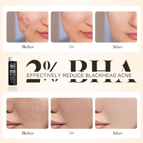 2% BHA Salicylic Acid Liquid Exfoliant Serum For Blackhead Removal,Unclog Pores,Smooths skin118mL 4 fl OZ Face Exfoliator For Facial Skin Care
