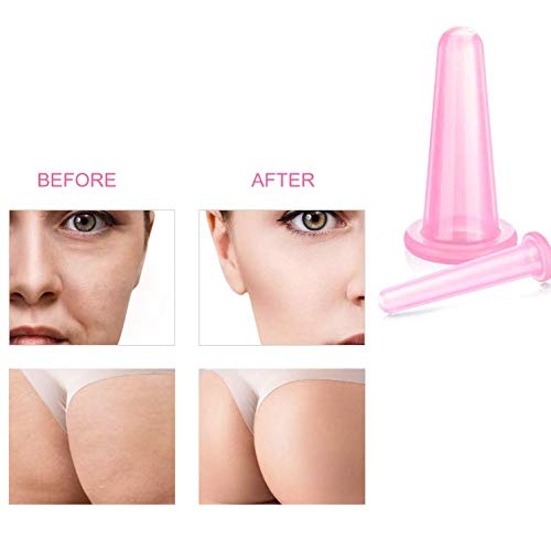 Aeyistry 4Pcs Cupping Facial Set for Face and Eye Cupping Massage, Facial Cupping Set Silicone Cups with Exfoliating Brush for Face Neck Skin (2 Small&2 Large, Pink)