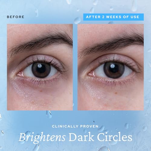 belif Aqua Bomb Cooling Eye Gel - Caffeine & Hyaluronic Acid for Puffiness & Hydration, Niacinamide & Vitamin C for Dark Circles, Adenosine & Collagen for Plumping & Firming, Korean Skin Care