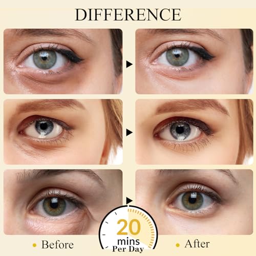 Aurchdly Under Eye Patches(24K Gold 30 Pairs), Gel Eye Mask for Reduce Dark Circles, Puffy Eyes,Undereye Bags, Wrinkles,-with Hyaluronic Acid & Collagen,Eye Treatment Skin Care for Men & Women Gift
