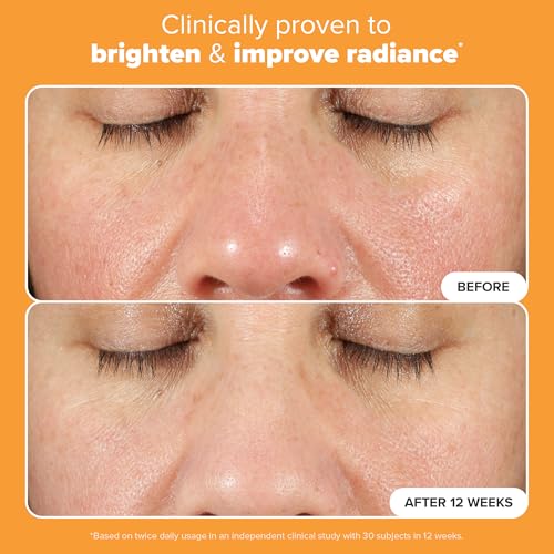 Paula's Choice BOOST C15 Super Booster, 15% Vitamin C Serum for Face, Face Serum with Vitamin E & Ferulic Acid for Discoloration & Glow, Fragrance-Free, 0.67 Fl Oz