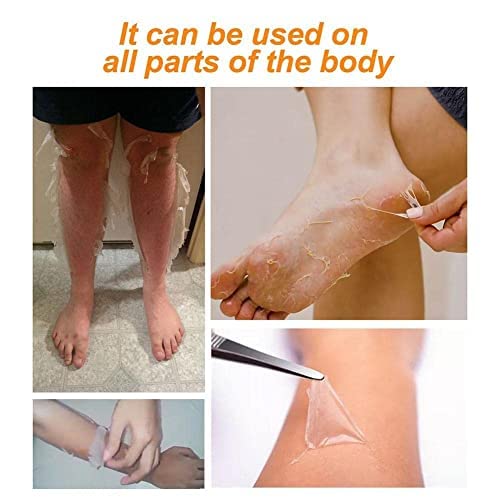 2PCS Orange Peeling Lotion, Body Peeling Lotion, Instant Exfoliation Dead Skin Remover Peeling Gel for Skin Body Face Neck Knees Foot