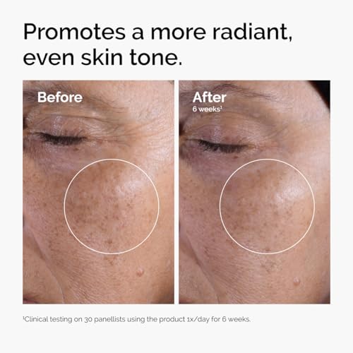 The Ordinary Glycolic Acid 7% Exfoliating Toner, Brightening and Smoothing Daily Toner for More Even-Looking Skin Tone, 3.4 Fl Oz