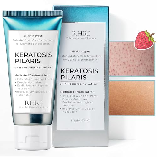 Keratosis Pilaris Treatment | Keratosis Pilaris Lotion | KP Lotion | Gentle Exfoliation For Strawberry Legs, KP & Ingrown Hairs | Smooth & Hydrating Body Lotion For Redness, Dry, Rough And Flaky Skin