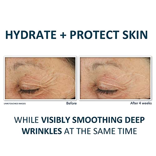 RoC Retinol Correxion Deep Wrinkle Daily Face Moisturizer with Sunscreen SPF 30, Skin Care for Fine Lines, Dark Spots, Post-Acne Scars, Stocking Stuffers for Men & Women, 1 Ounce (Packaging May Vary)