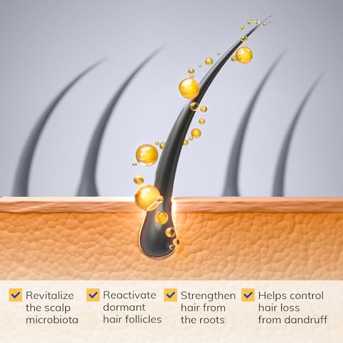 RootStim Anti-Dandruff Shampoo for Seborrheic Dermatitis and Folliculitis: Anti-Fungal Medicated Shampoo for Scalp Problems - Psoriasis Itchy and Oily Scalp Relief for Men & Women Sulfate Free