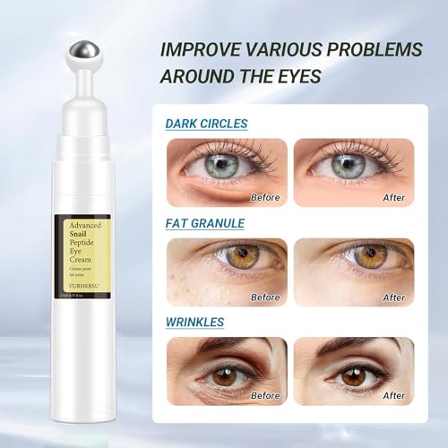 ELCHHIRSCH Snail Peptide Under Eye Cream with 73% Snail Mucin & 2% Nicotinamide for Dark Circles, Puffiness & Wrinkles, with 360° Massaging Roller Ball, 0.57 fl oz