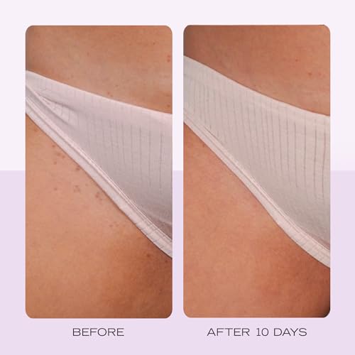 First Aid Beauty - Ingrown Hair Pads with BHA + AHA - Aftershave Treatment Pads to Help Prevent Razor Bumps for Men & Women - Exfoliate Underarms & Bikini Area - Compostable for Daily Use - 28 Pads