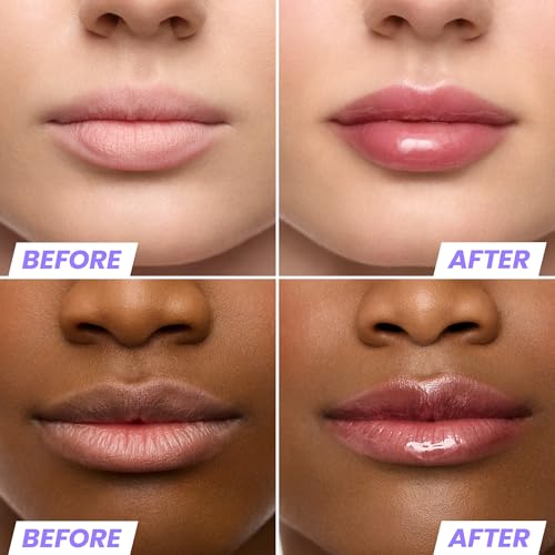 Wonderskin Lip Oil Rehab Serum - Tinted Lip Oil, Hydrating, Moisturizing, and Non-Sticky Deep Red Tint Serum for Dry Lips (Honey)