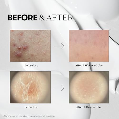 VT COSMETICS CICA Reedle Shot 300, Advanced Night Exosome, Microneedling Serum, Centella Asiatica, Hyaluronic Acid, Propolis, Soft Skin, Regeneration, Glass Skin, Korean Skin Booster 1.69Fl Oz (50ml)