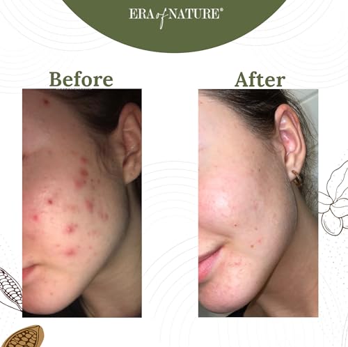 era of nature Best Raw ORGANIC AFRICAN BLACK SOAP, for Dry Skin and Skin Conditions. Pure & Natural Ingredients, Imported From Ghana - 1lb (16oz)