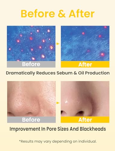 Elvira Pore Control Cleansing Oil, Makeup Remover for Sensitive, Oil Cleanser for Face, Blackhead Removal, Korean Skin care, Hydrating, Fragrance-Free