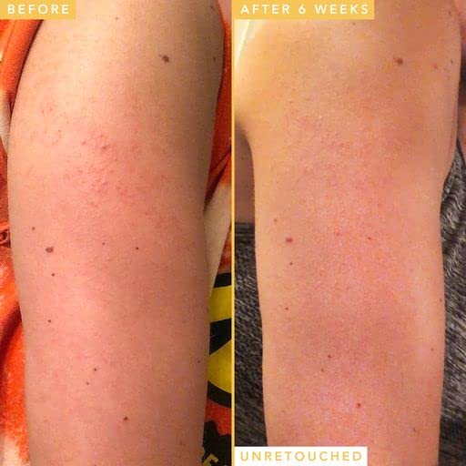 Farmacy Honeymoon Glow Body - AHA and BHA Body Serum with Hyaluronic Acid - Resurfacing Lactic Acid Body Lotion for Dry Skin