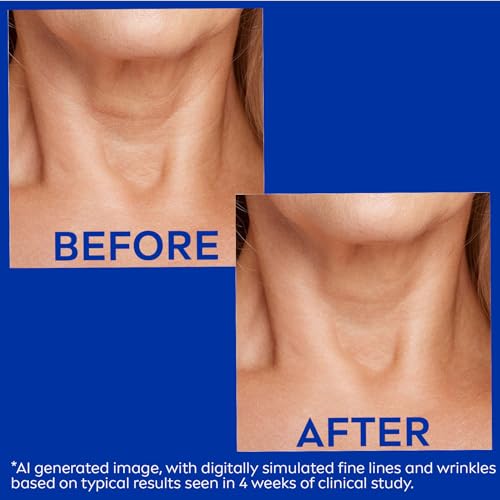 NIVEA Skin Firming and Anti Wrinkle Neck and Chest Cream with Q10, Creatine and Provitamin B5, Skin Firming Body Cream Reduces the Look of Fine Lines and Wrinkles, 6.7 Oz Tube