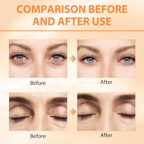 REATIFUL 2PCS Revive Glow Vitamin C Eye Balm, Reducing Dark Circle,Hydrating Eye Cream,Improve Dark Circles,Reduces Puffiness (2pcs)