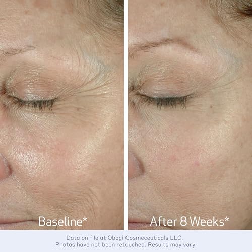 Obagi ELASTIderm Eye Cream – Lightweight, Smooth Formula Clinically Proven to Help Reduce the Appearance of Fine Lines & Wrinkles – 0.5 oz