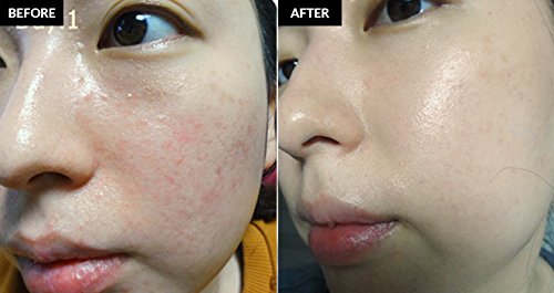 Klairs Midnight Blue Calming Cream, Facial Spot Cream, Calming Cream, Night Calming Spot Cream, 30Ml, 1.01Ounce