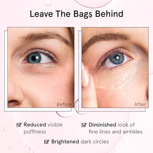 grace & stella Under Eye Brightener Roller - Retinol & Caffeine Eye Serum for Puffiness, Dark Circles, Fine Lines & Wrinkles - Hydrating & Smoothing - Vegan Cruelty-Free Skincare (15ml / 0.51 fl oz)