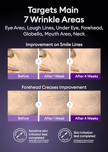 MISSHA Time Revolution Night Repair Retinol Intensive Ampoule 0.33 Fl oz - Advanced Korean Facial Serum for Skin Barrier Strengthening, Improved Elasticity, Radiance, Overnight Moisturization.