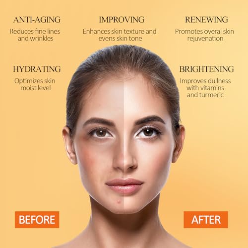 Vitamin C Face Mask with Kaolin Clay and Turmeric for Dark Spots, Dull Skin, Skincare Facial Mask for Controlling Oil and Refining Pores 5.29 Oz