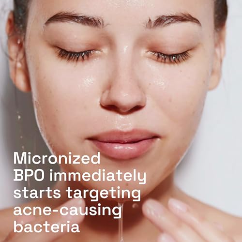 Cetaphil Gentle Clear Complexion-Clearing BPO Acne Cleanser with 2.6% Benzoyl Peroxide, Creamy and Soothing for Sensitive Skin, Suitable for All Skin Types, 4.2oz