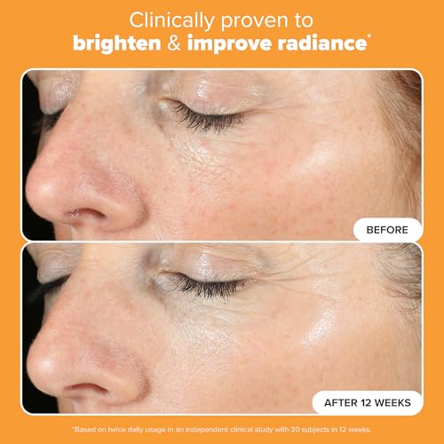 Paula's Choice BOOST C15 Super Booster, 15% Vitamin C Serum for Face, Face Serum with Vitamin E & Ferulic Acid for Discoloration & Glow, Fragrance-Free, 0.67 Fl Oz