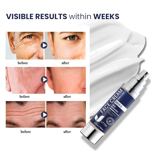 6-in-1 Face Cream for Men: Anti Aging & Wrinkle Cream for Men with Collagen, Hyaluronic Acid, Vitamins E & B, Shea Butter - Dark Spots Remover & Eye Bags Treatment for Men - 1.7 oz.